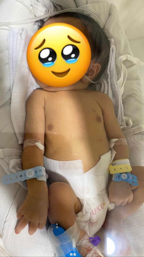 anak sakit masuk ruang perinatologi