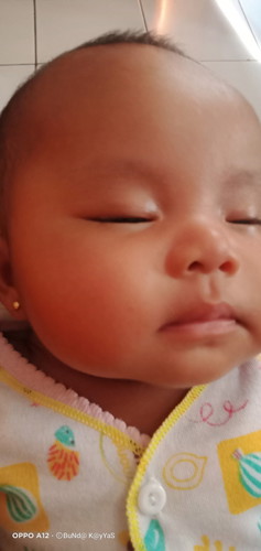 Anak sya mencret udh 3 minggu ga smbuh umur ny 3bln udh brobt ke bidan dan ke dr ank blm smbuh jg