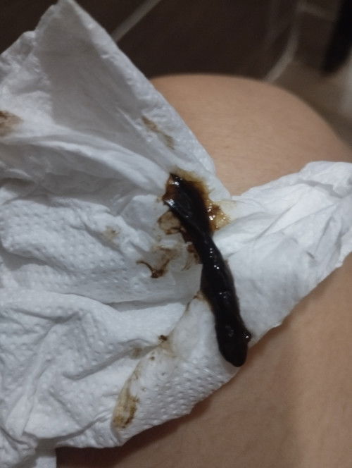 Keluar cecair berwarna coklat