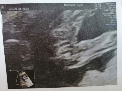 หญิงหรือชายคะ