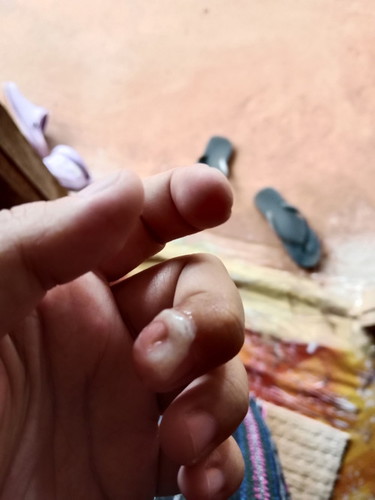 ตั้งครรภ์38+4