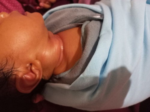 Leher bayi umur sebulan