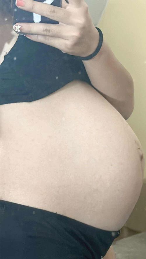 33วีค 5วัน ท้อง2ค่ะ