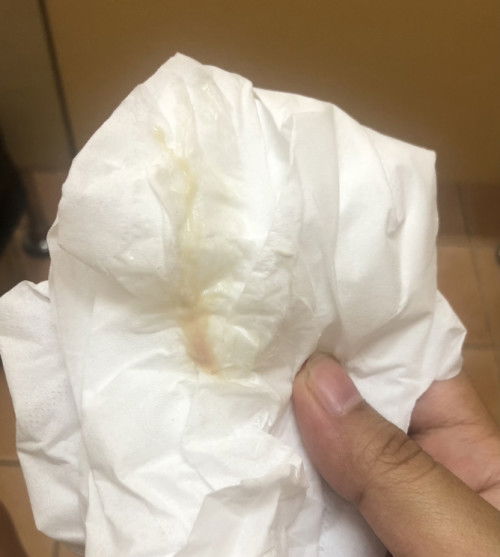 มีตกขาวแบบนี้ คือใกล้คลอดยังคะแม่