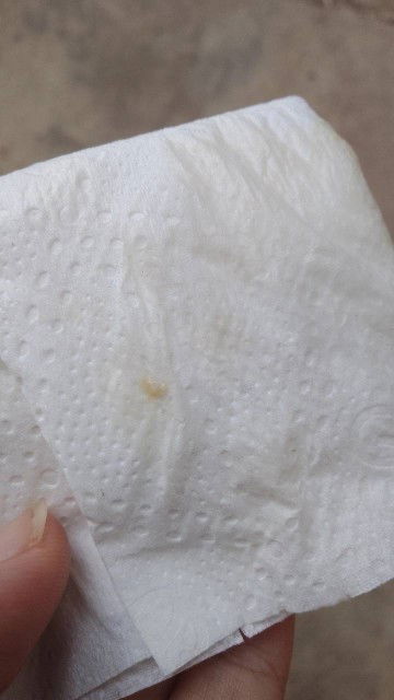 คืออะไรคะ ใช่มูกไหม