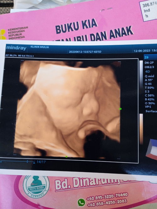 Tentang usia kehamilan