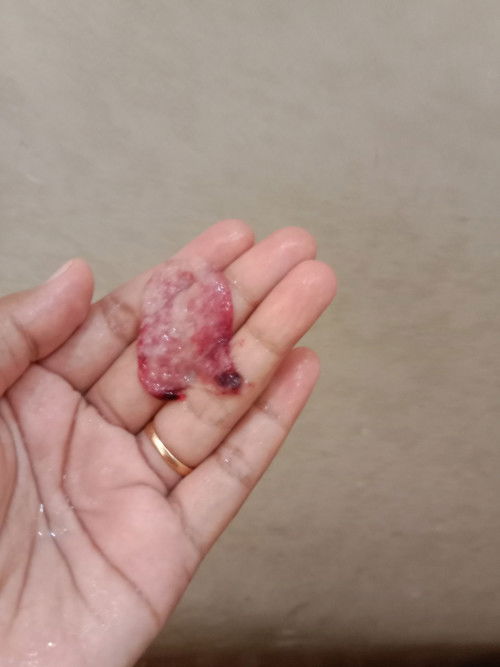 Apakah ini termasuk kantung janin?