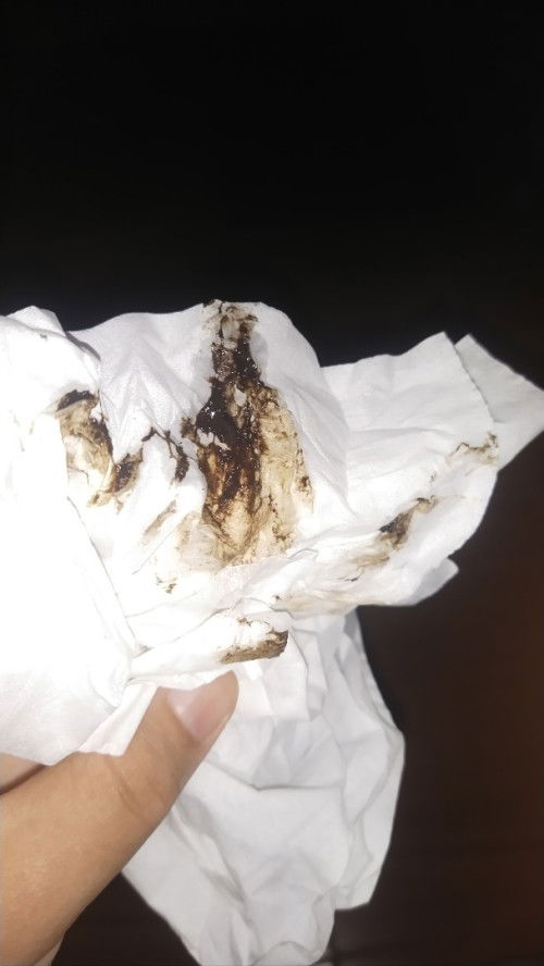 มีมูกสีคล้ำๆ