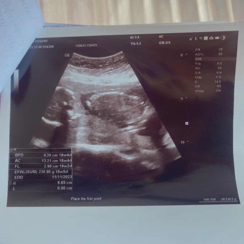 ขอคำแนะนำหน่อยค่ะ