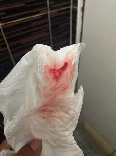 ขออนุญาตสอบถามค่ะเราท้องแรกไม่รู้จริงๆ