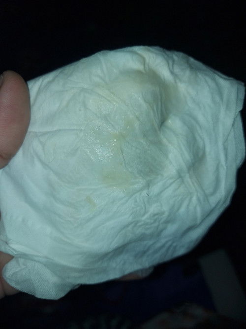 สอบถามแบบนี้ใช้มูกไหมค่ะ ท้องแรก แม่ไม่ทราบเลยค่ะ ไม่มีอาการปวดท้องเลย