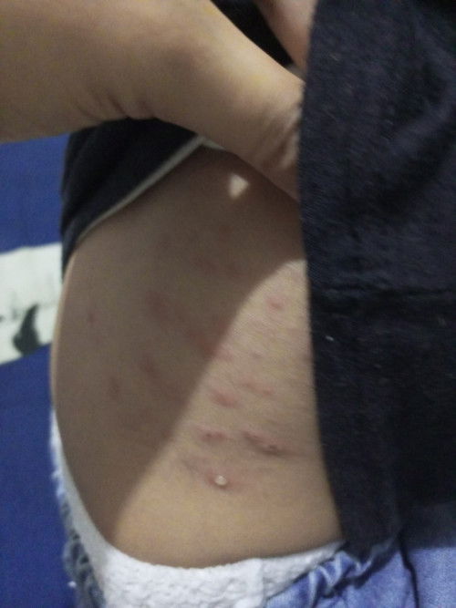 ada yang pernah ngalamin kah???