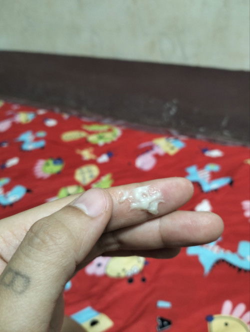 มูกหรือตกขาว