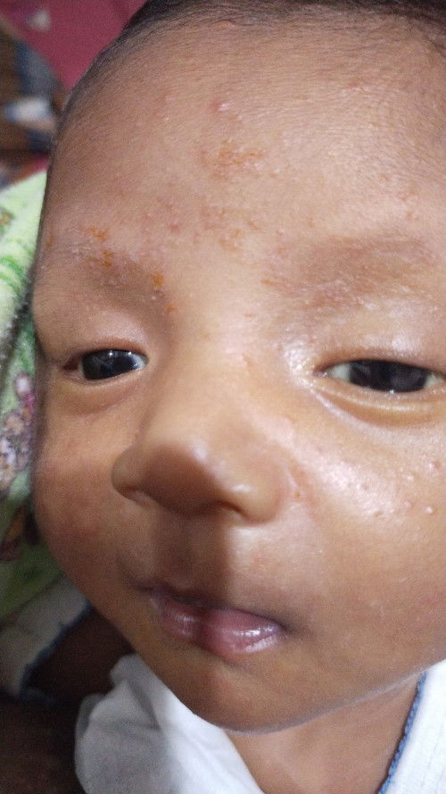 Ada yg pernah ngalami gk bun?