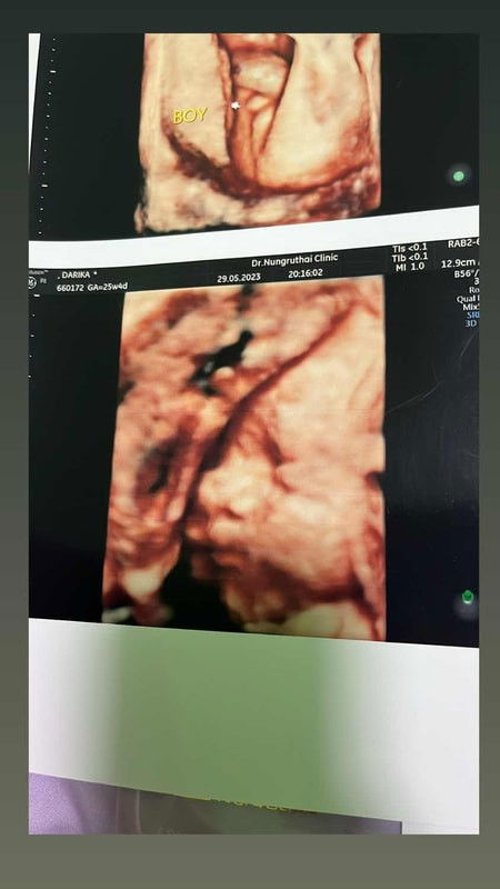 แม่ๆช่วยตั้งชื่อน้องหน่อยครับ