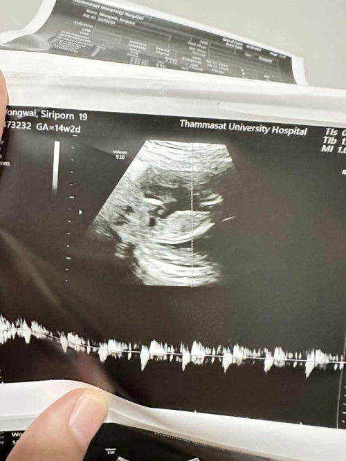 แม่ๆช่วยดูหน่อยค่ะว่าเพศอะไร?