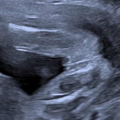 Boy or girl?