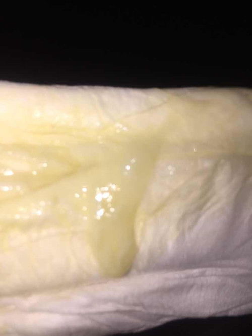 แบบนี้คือตกขาวหรือมูกคลอดค่ะ