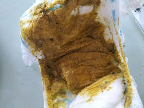 Poop ni baby normal lang po ba to? pasintabi p.