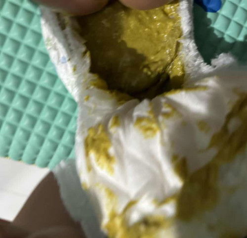 Pup bayi apakah normal?