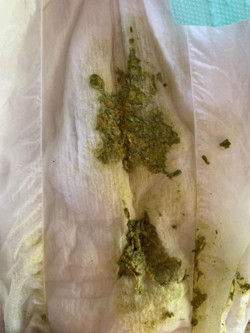 สอบถามแม่ๆหน่อยค่ะ😥😥กังวลมาก