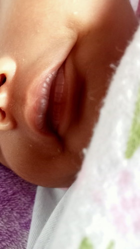 Mga mi normal po ba ito?
Nag ddark and crack lips si baby 10 days old palang po kmi.