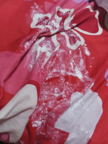 Lungad lang po ba ito? or suka ni baby?