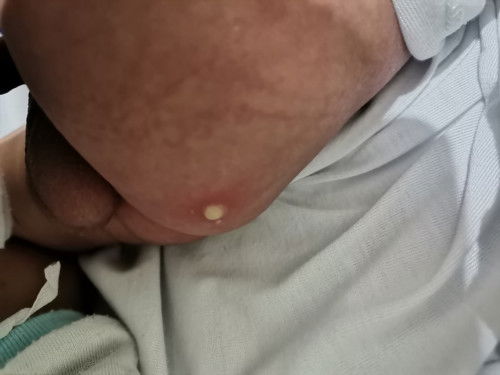 Parang may tumubo sa pwet ni baby