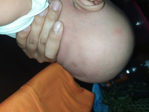 apakah bentuk kepala ini normal?