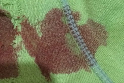 HPHT 05 MEI 2023, TESTPACK POSITIF TGL 12 JUNI 2023 dan PAS USG HAMIL