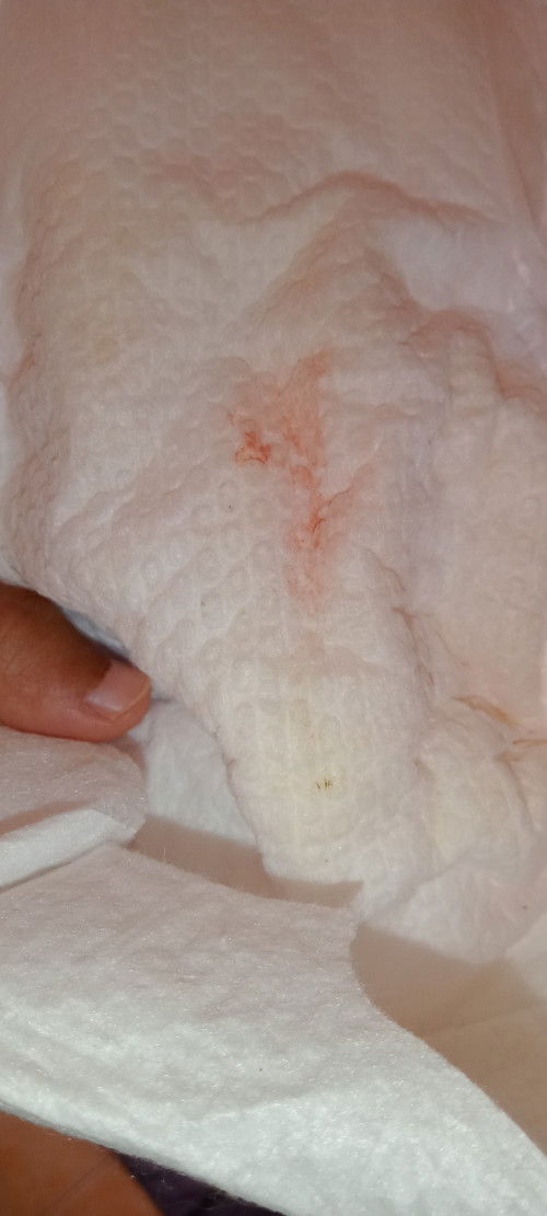 Warna merah pada popok