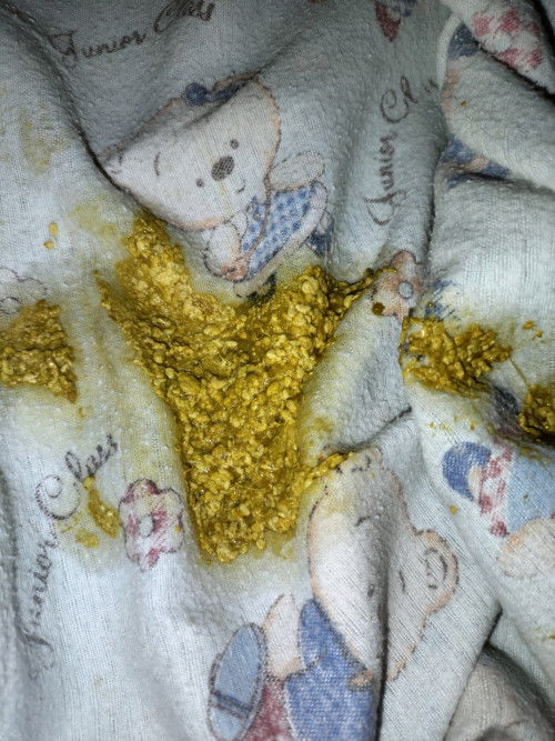 Maaf bun klo jorok.. Bayi sya baru 1 bln pup nya sprti ini normal ga yaa. Bayi sya sufor sama asi