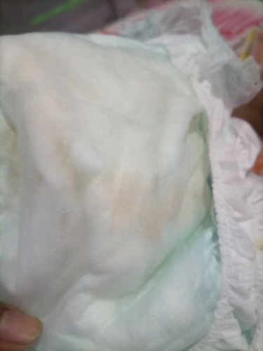 MAPULA SA DIAPER