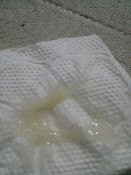 สอบถามหน่อยค่ะ 38วีค