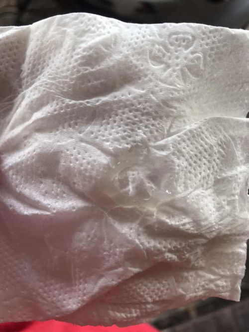 ตั้งครรภ์34wมีมูกใสๆไหลออกมา