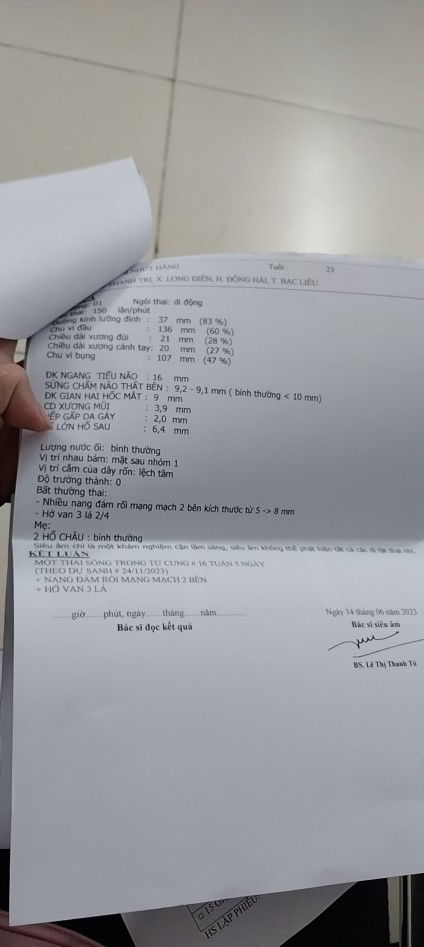 E bé 17 tuần bị như này có s k ạ 🥲