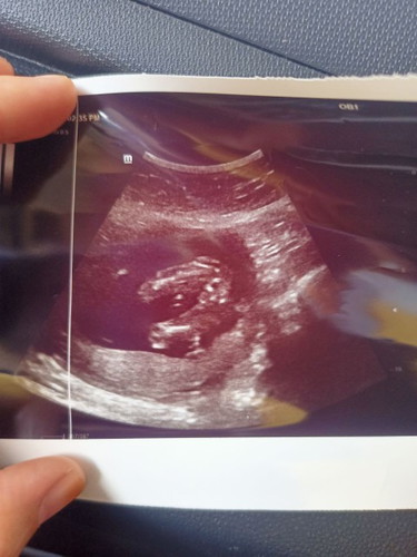 Gender baby