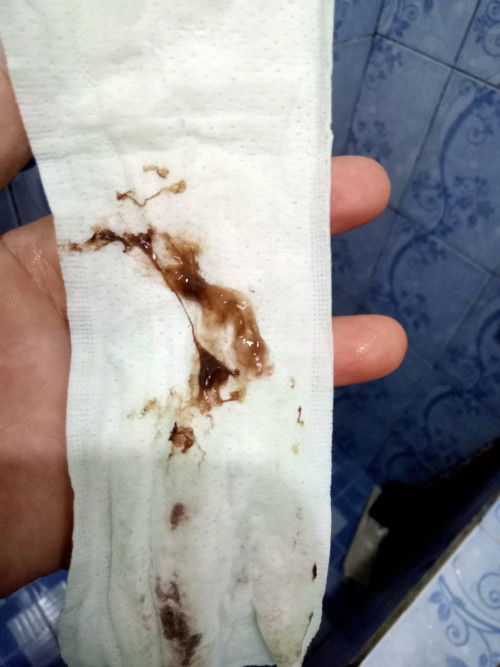 Keluar lendir + flek coklat apakah tanda persalinan?