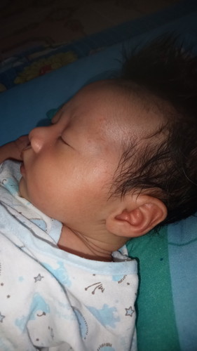 หัวลูกบุ๋ม