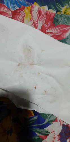 มีมูกออกและท้องแข็ง