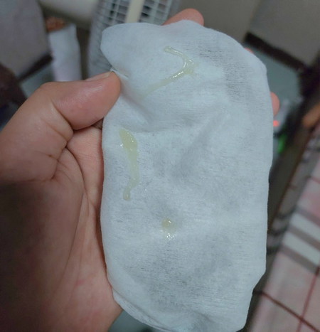 มีมูกแบบนี้ อีกนานมั้ยคะกว่าจะคลอด