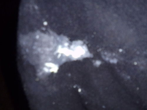 อันนี้คืออะไรอันตรายหรือเปล่า