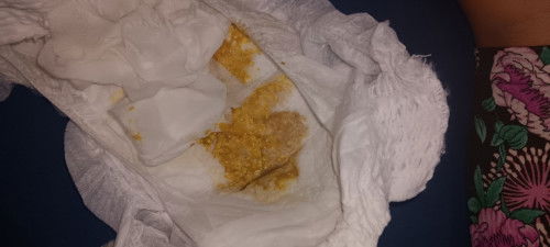 Kalau poop nya gini, tanda nya apa ya bun?