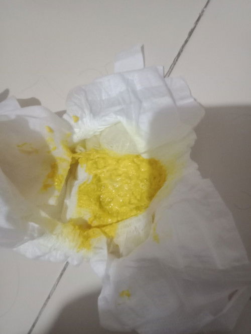 น้องถ่ายแบบนี้ผิดปกติไปคะน้องทานนมผงค่า