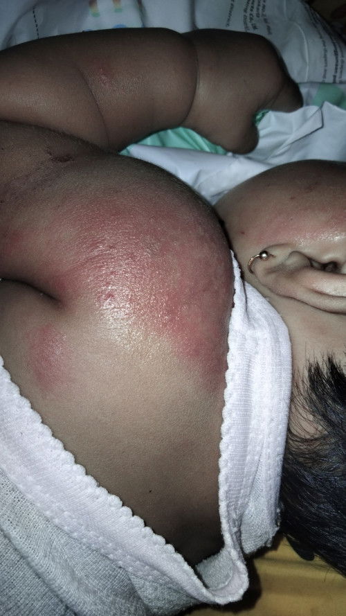 Bun cara mengobati ini gimana ya kak maklum newmom 🙏😥