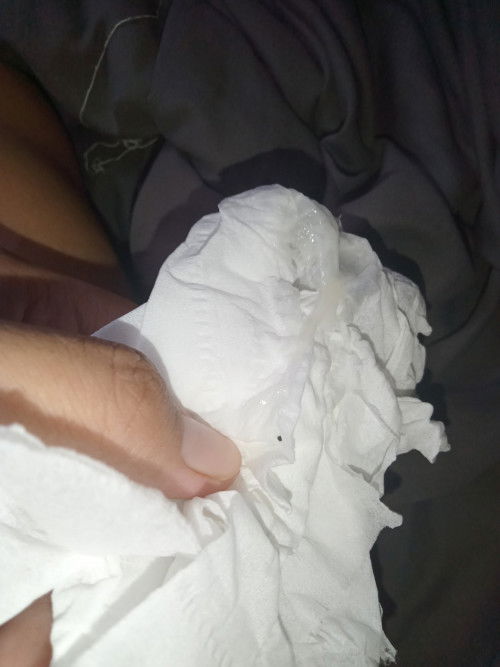 ท้องได้37+4วีค