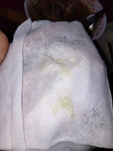 มีมูกไหลยังไม่มีอาการอื่น