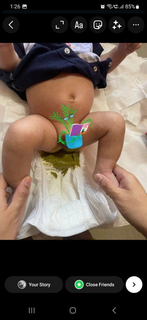 Baby poop colour