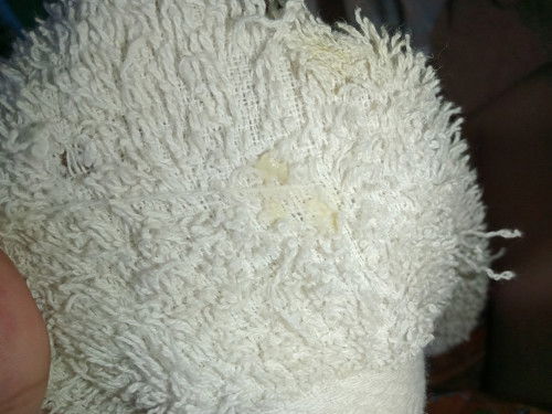 Kenapa keputihan berubah warna saat hamil 6 bln?