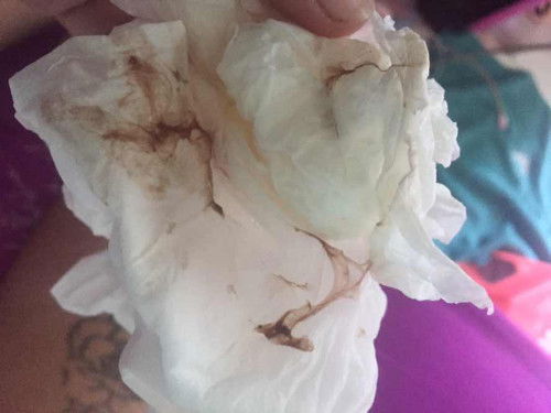 Apakh ini tnda melahirkan ?? Maaf sedikit jorok 🙏🏻🙏🏻